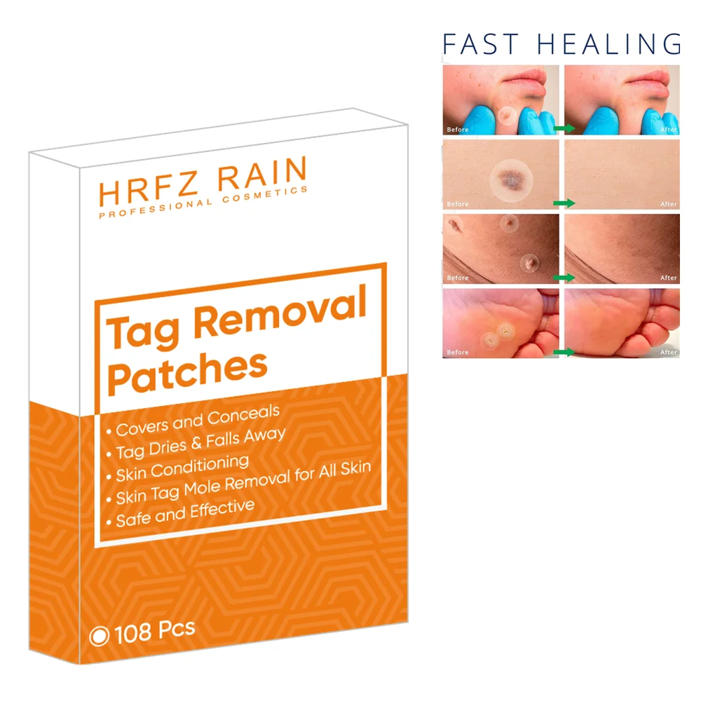 

Skin Tag Remover Warts Remover Patch Wart Treatment Cream Herbal Extract Foot Corn Plaster Acne Warts Ointment callus remover