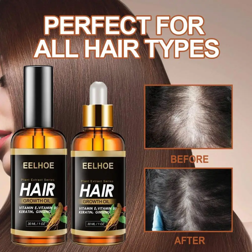 

30ML Hair Growth Conditioner Effective Hair Oil Multifunctional Herbal Ingredients Hair Care Oil Hair Oil for Salon