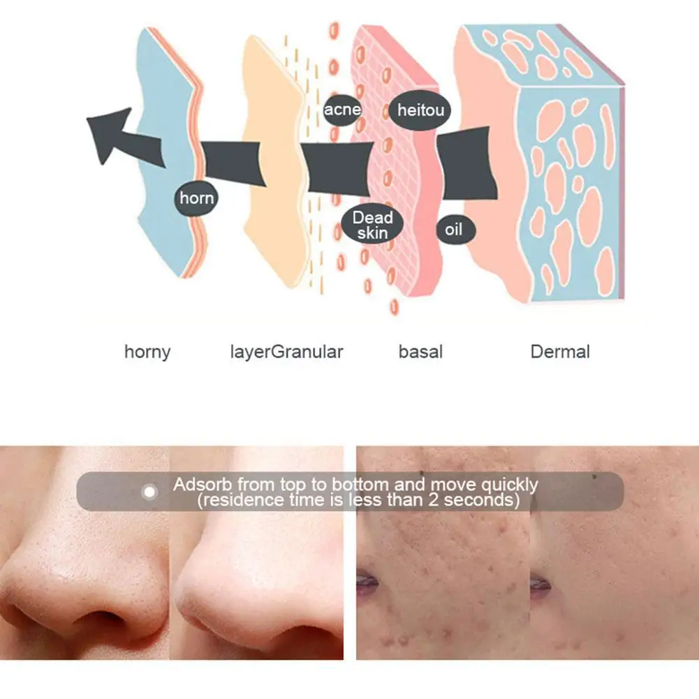 

Creativity Small Conch Style Electric Blackhead Remover Skin Blemishes Removal Pore Acne Cleaner Comedone Extractor Tool