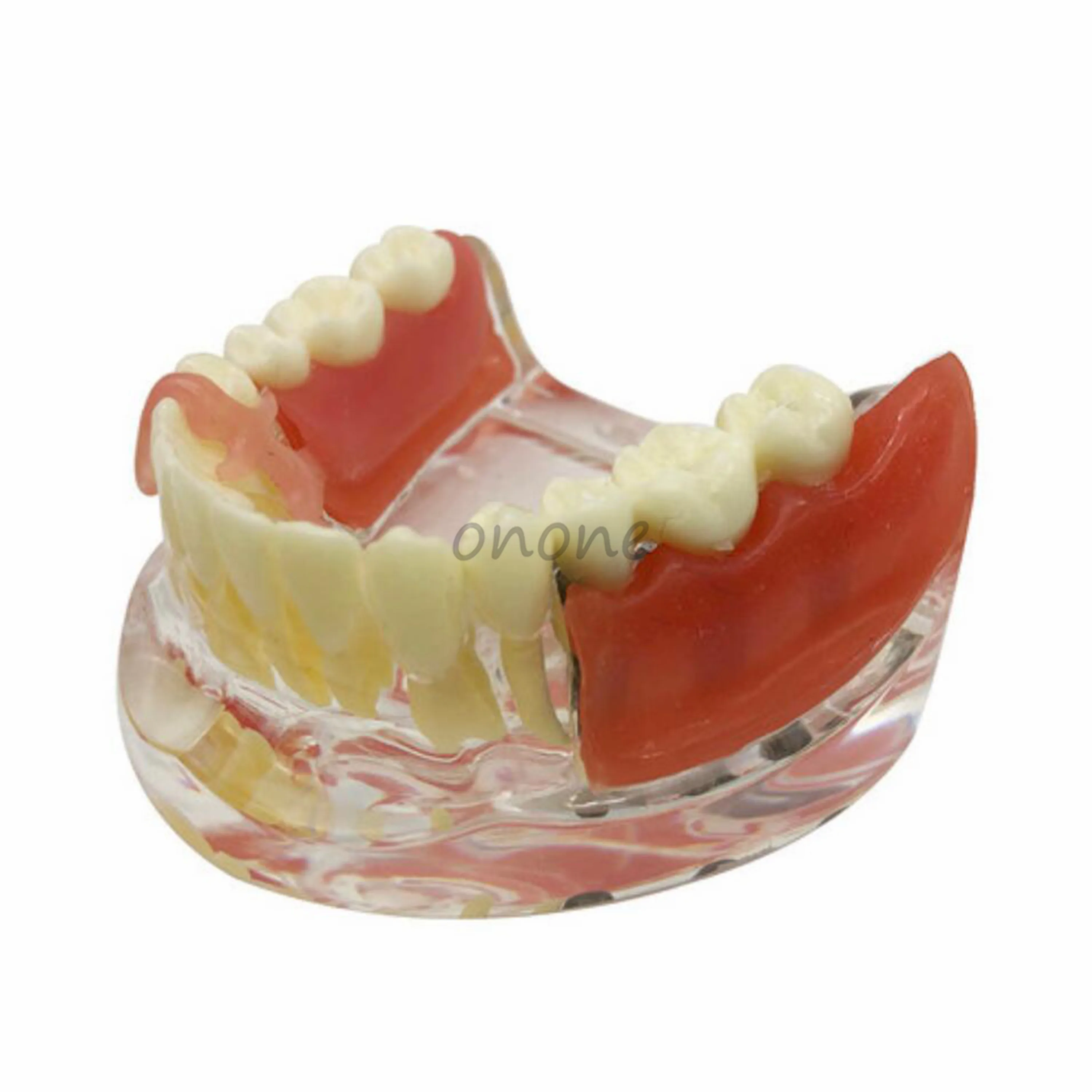 Фантом челюсти. Мягкая десна. Мягкая десна. Мягкая десна. Мягкая десна.