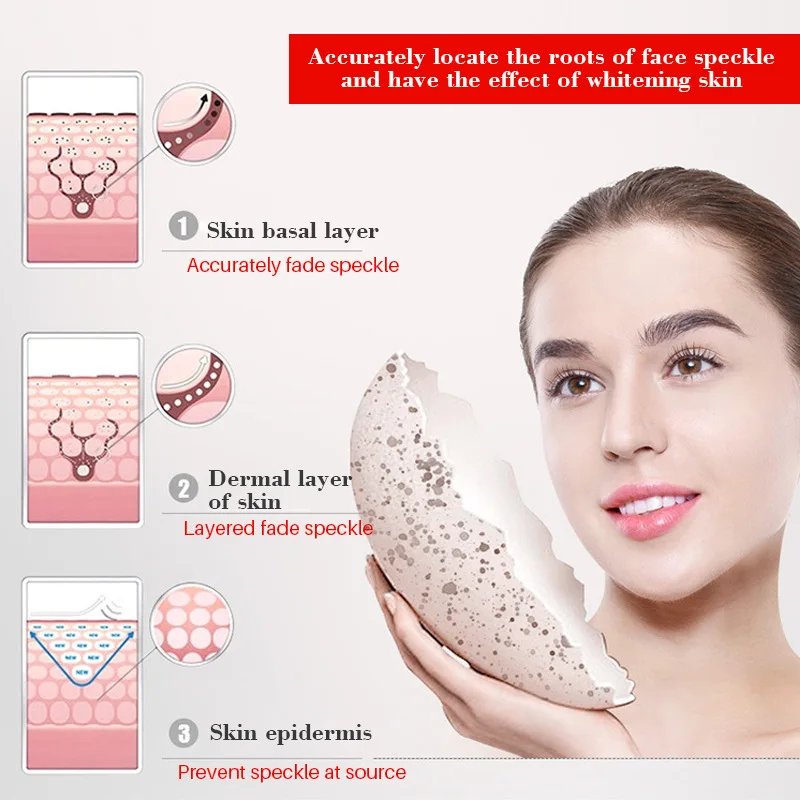 Отбеливающий крем от веснушек для удаления мелазмы акне темные пигментные пятна