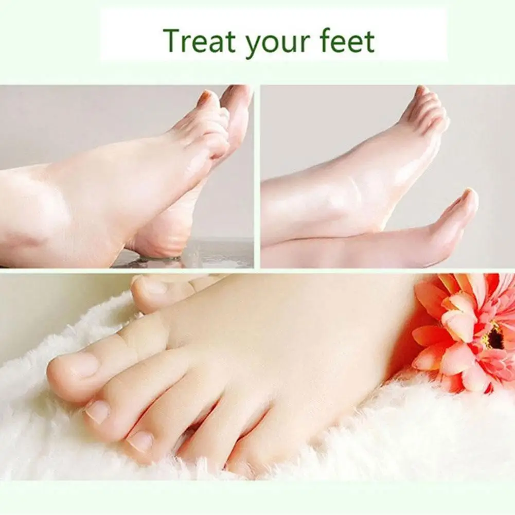 

30ml Balsamic Vinegar Foot Care Exfoliating Foot Bath Whitening And Moisturizing Foot Skin To Relieve Fatigue