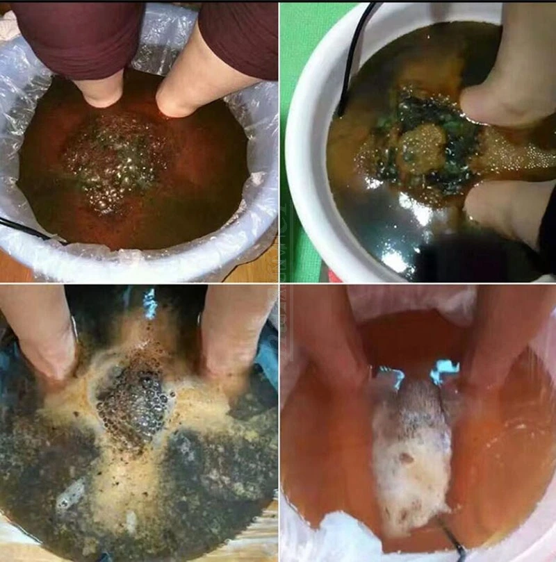 Машина для детоксикации ног двойной ион очистка детоксикационное спа-устройство