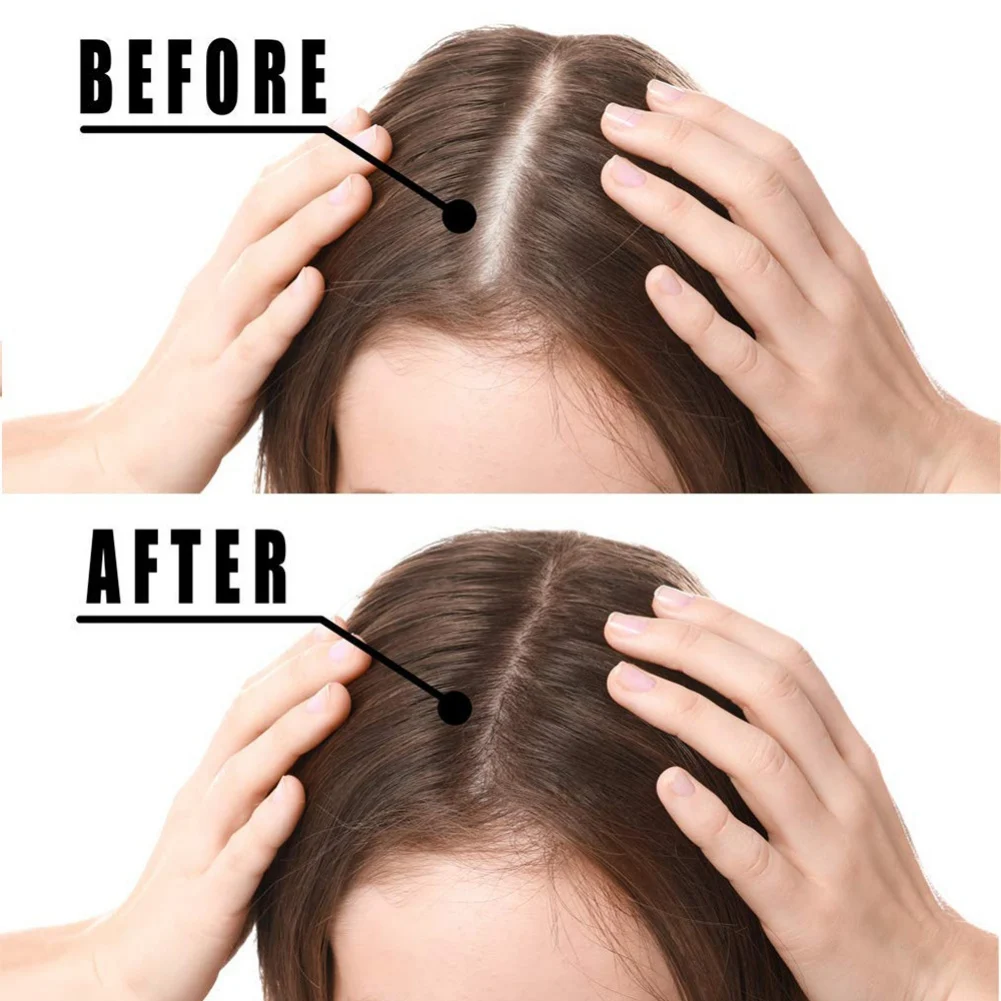 

Anti Hair Loss Hair Strengthen Hair Roots Thickening Serum Promote Hair Growth Regrowth Product For Men Women Hair Growth Serum