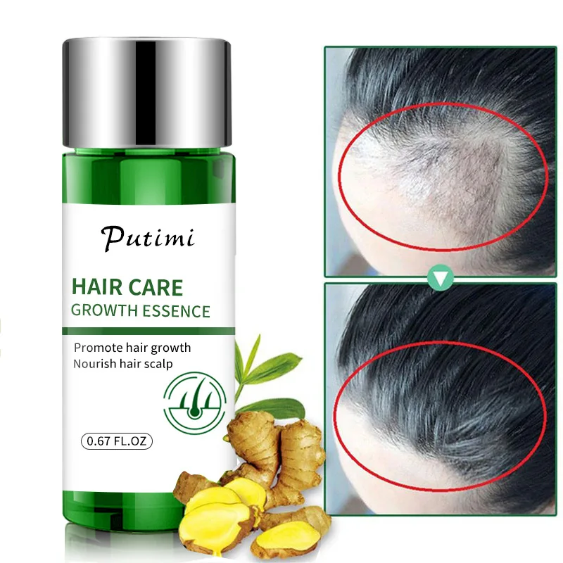 

Ginger Hair Growth Essential Oils Promote Hair Regrowth Essence Prevent Baldness Hair Loss Hair Serum Repair Damaged Hair Care