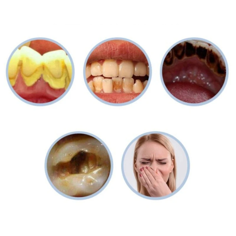 Лидер продаж домашний ультразвуковой безводный очиститель зубов