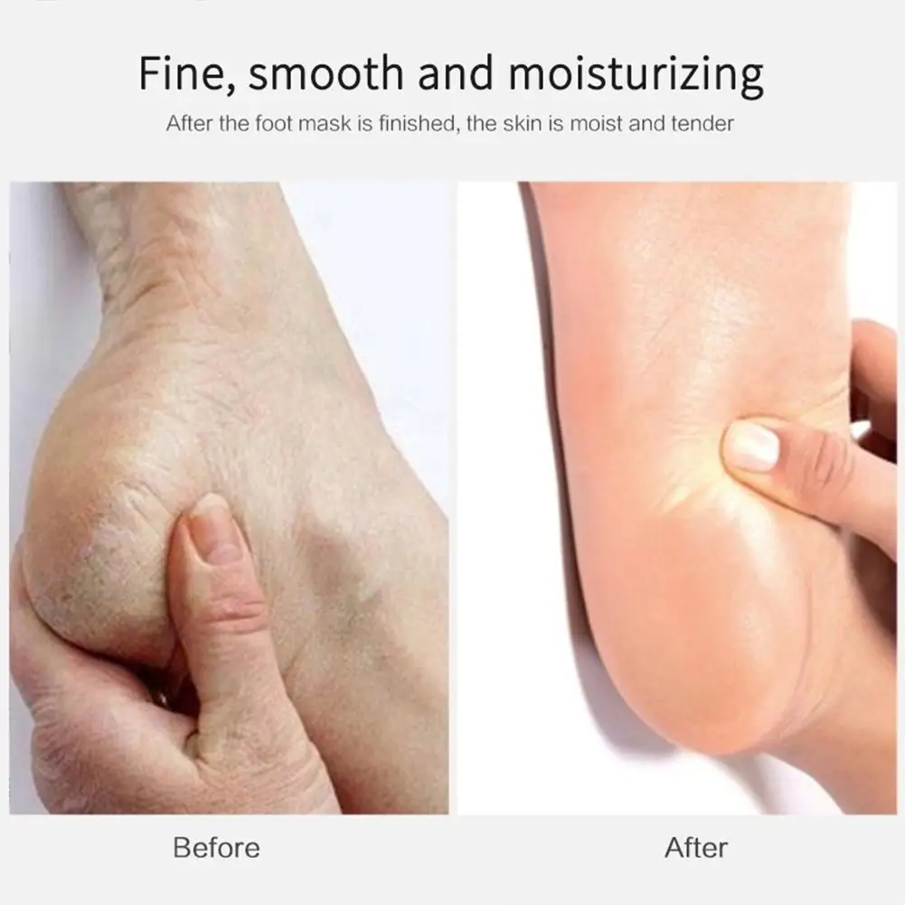 

Liquid Goat Milk Foot Mask Female Nourishing Hydrating Moisturizing Foot Mask Exfoliating Foot Skin Care Mask