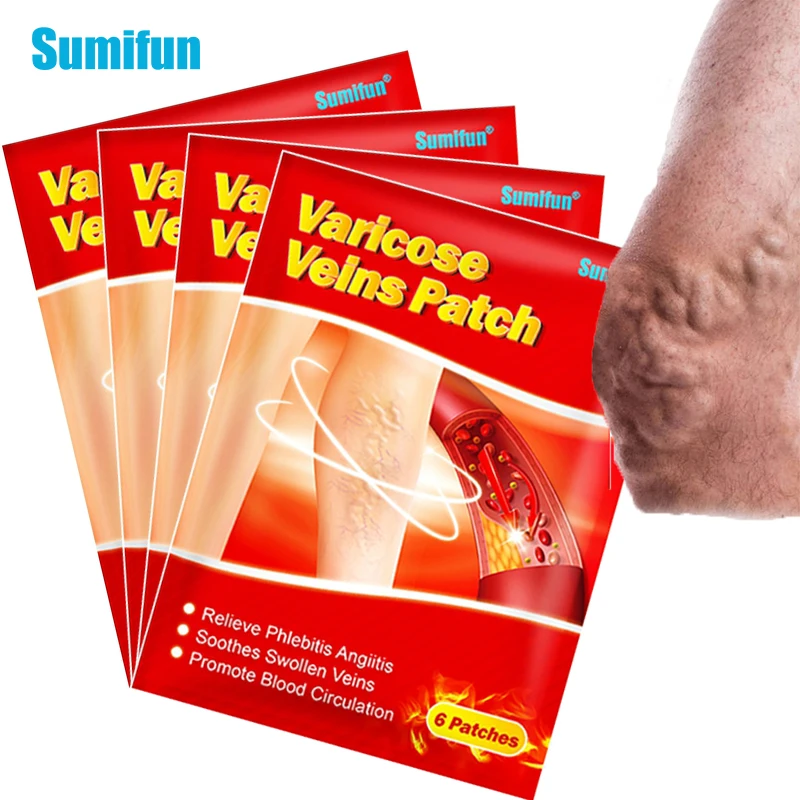 

24pcs Sumifun Varicose Veins Plaster Vasculitis Phlebitis Spider Cream Varicosity Angiitis Removal Herbal Medical Plaster K06201
