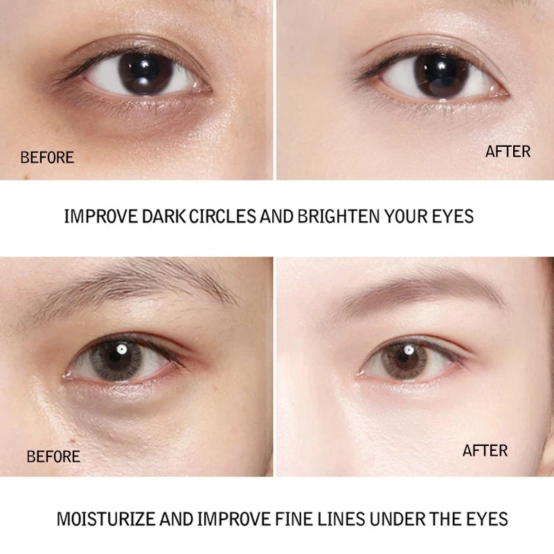 60pcs Dragon Blood Nicotinamide Repair Eye Patches Remove Dark Circles Moisturizing Mask Crystal Collagen Gel Skin Care |