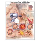 Картина Здоровье среднего уха, холст с печатью постера, настенная живопись для медицинского образования, для докторов, офисных классов