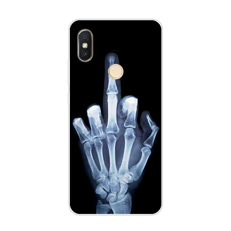 Чехол-накладка для Xiaomi Redmi S2 ТПУ силиконовый чехол с объемным рисунком Y2 |