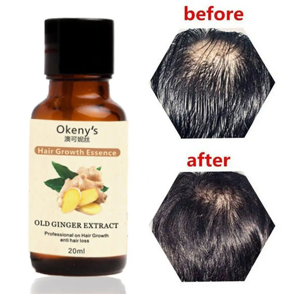 Hair Growth Loss Liquid 20ml Dense 1 Bottle Fast Organic Grow Restoration Pilatory | Красота и здоровье