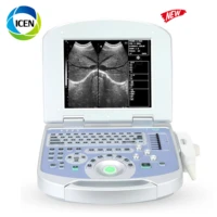 in a50 cheapest portable laptop 2d bw ultrasound therapy scanner diagnosis ultrasound machines