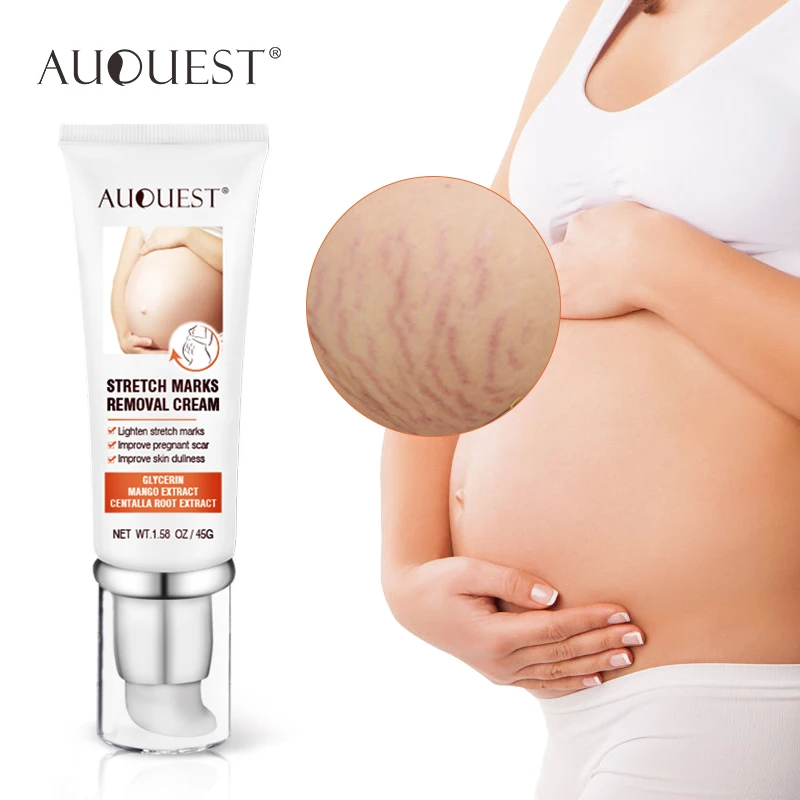 

AUQUEST Maternity Cream Stretch Marks Remove For Pregnant Women Treatment Skin Care Maternity Pregnancy Scars Body Cream 45g