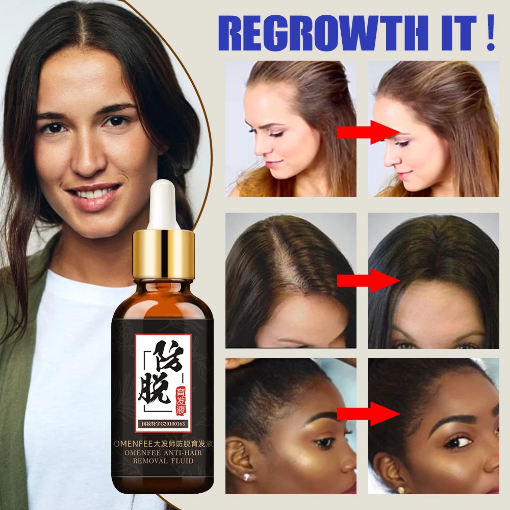 

Hair Loss Products for Fast Hair Growth Treatment Hair Essence Oil Natural Extracts Liquid Hair Care Regrowth Products Solutions