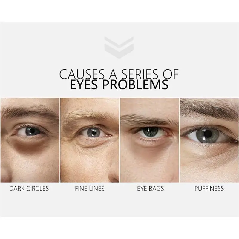 

30ml Men Anti Eye Cream Remove Dark Circles Puffiness And Bags Lighten Fine Lines Whitening Moisturizing Cream