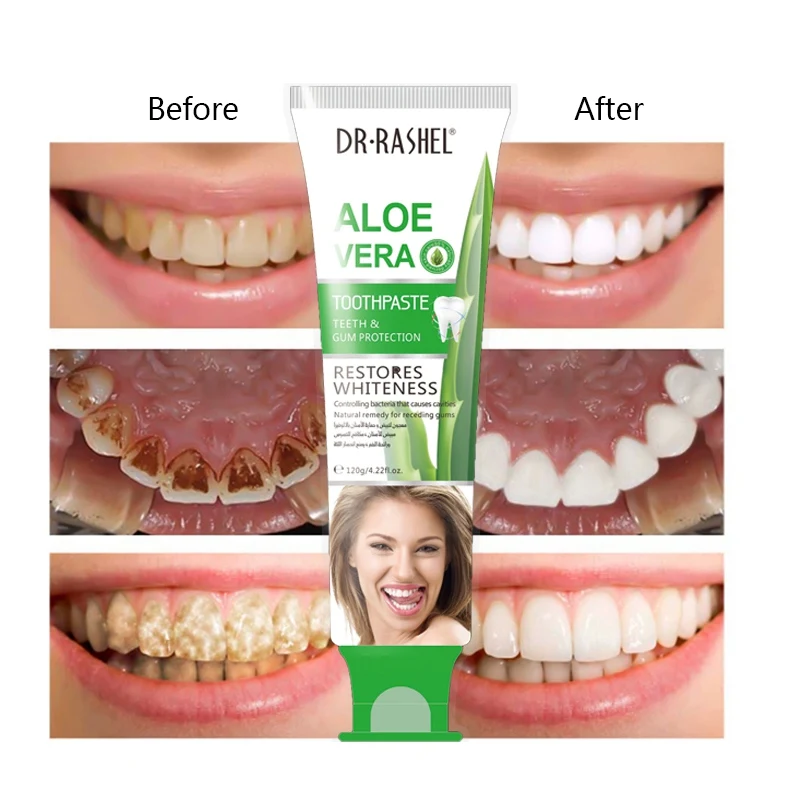 

Aloe Toothpaste Teeth Whitening Remove Oral Bacteria Odor Dental Cream Teeth Cleansing Product Oral Care Convenient