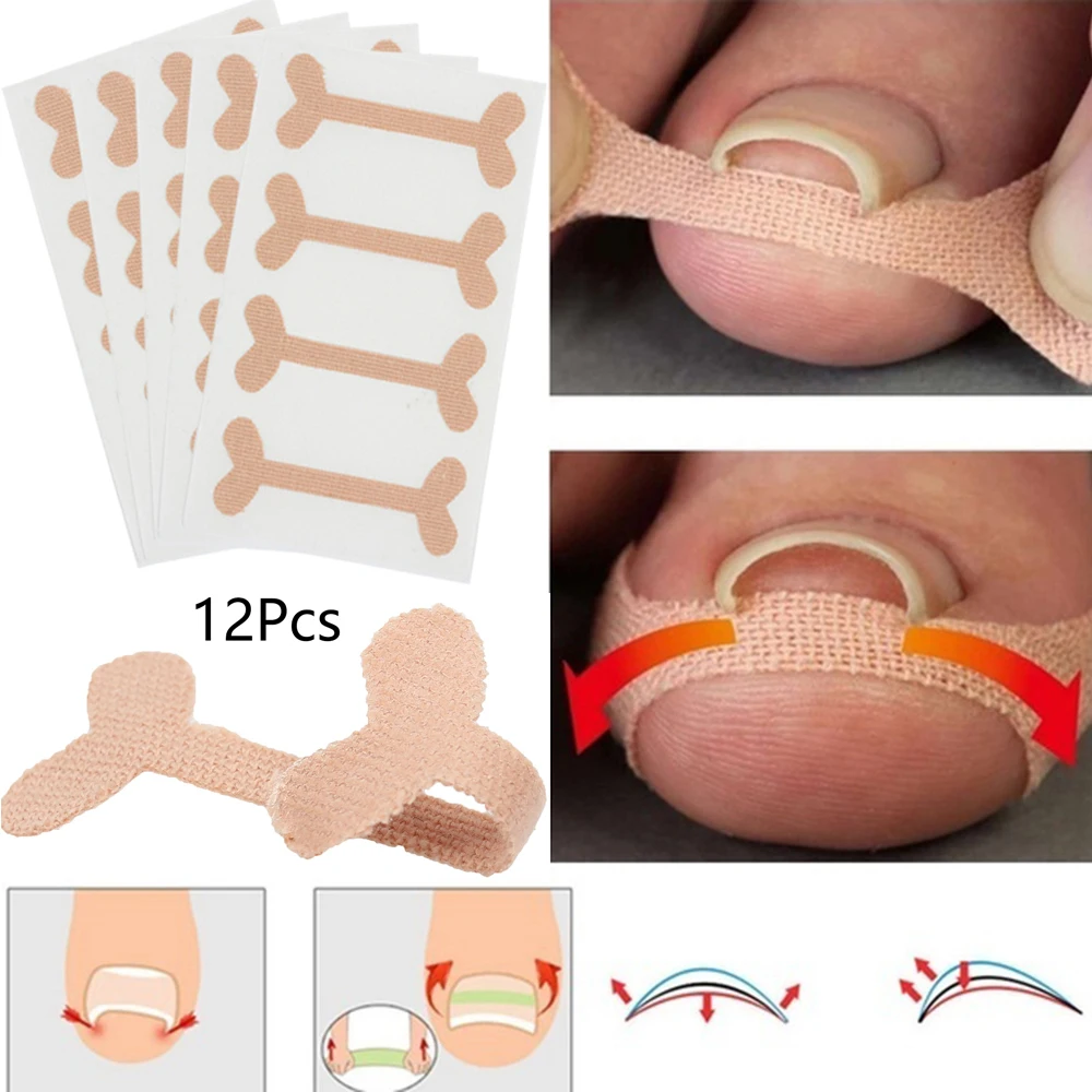 New Ingrown Toenails Band Aid Relief Pain Paronychia Correction Pedicure Elastic Force Sticker Repair Bandage Toe Nail Care