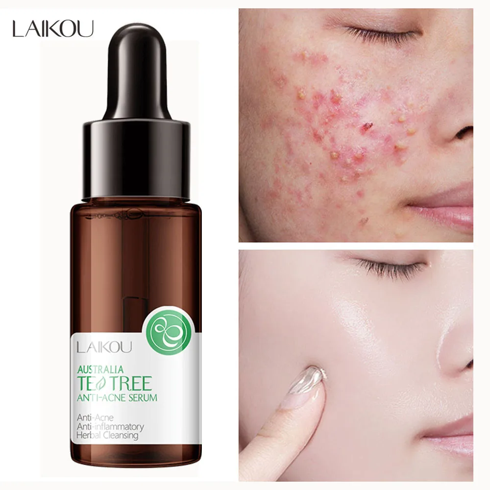 

LAIKOU Tea Tree Acne Serum Moisturizing Hyaluronic Acid Face Essence Oil Control Whitening Brightening Skin Care Anti-Aging 17ml