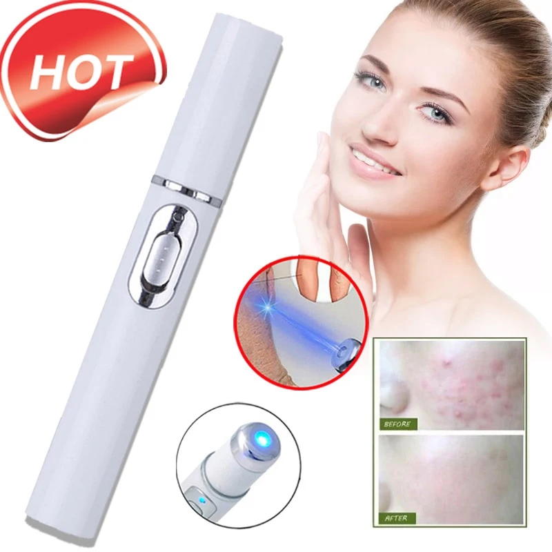 Портативный массажер для лечения варикозного расширения вен | Красота и здоровье