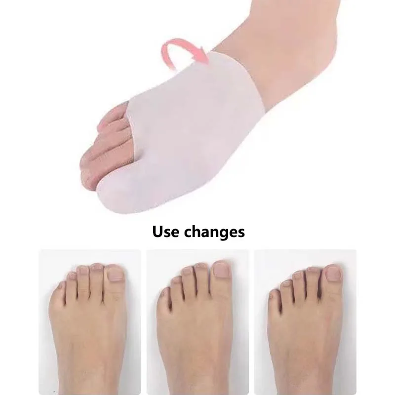 Разделитель большого пальца ноги при вальгусной коррекции деформации