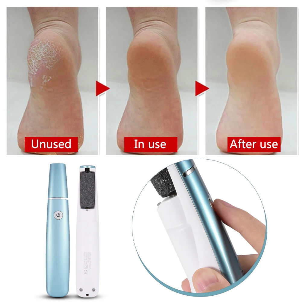Kemei USB Перезаряжаемые электрический набор для педикюра ухаживает за кожей стоп