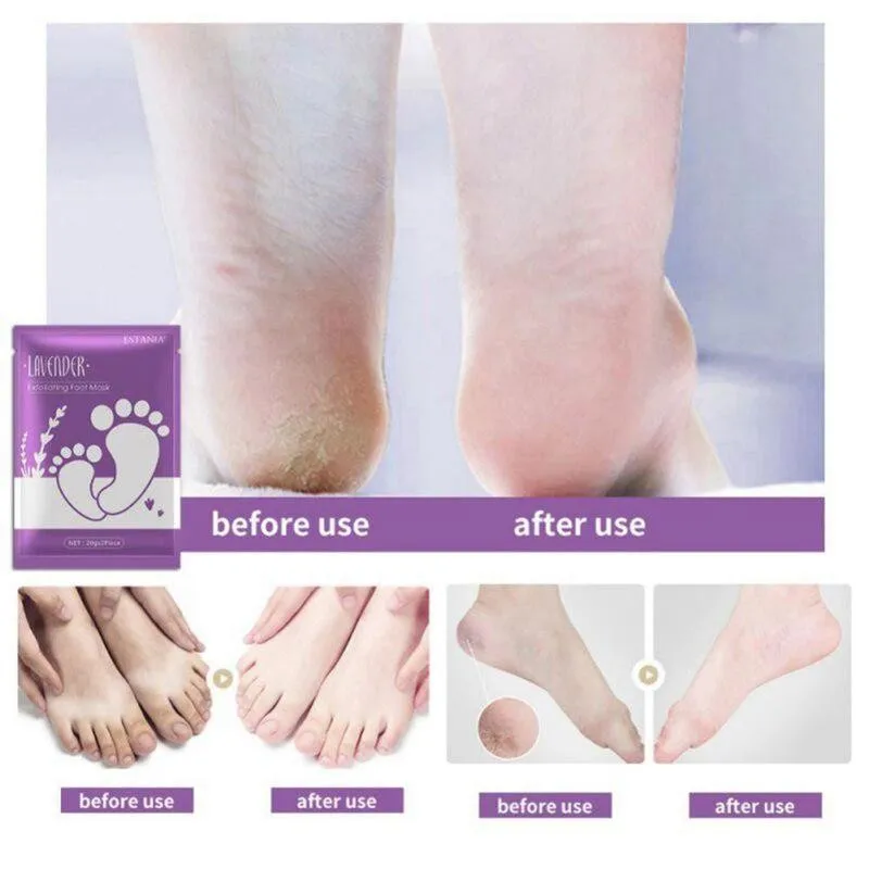 

1 Pair Dead Skin Remover Foot Mask Exfoliating Feet Mask Socks For Pedicure Peeling Foot Mask Feet Peeling Mask Foot Care