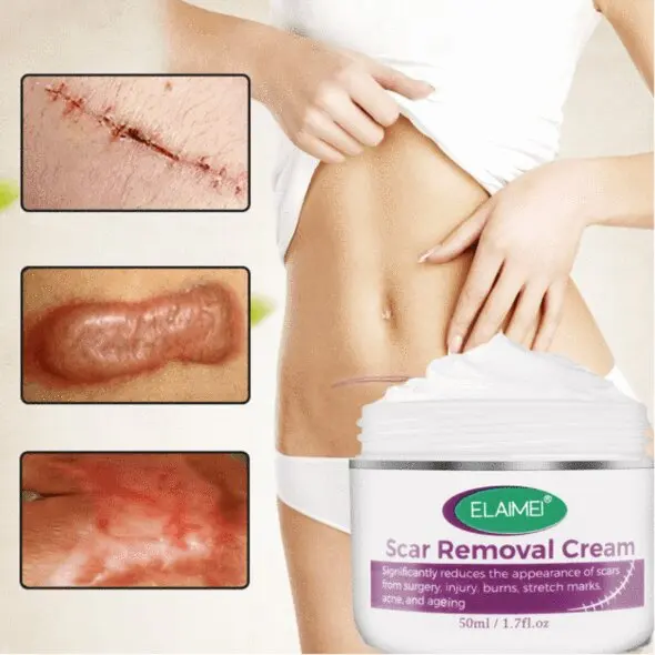 

Skin Rebound Scarless Cream Scar Removal Cream Face Cream For Face Acne Scar Stretch Marks Skin Repair Face Cream