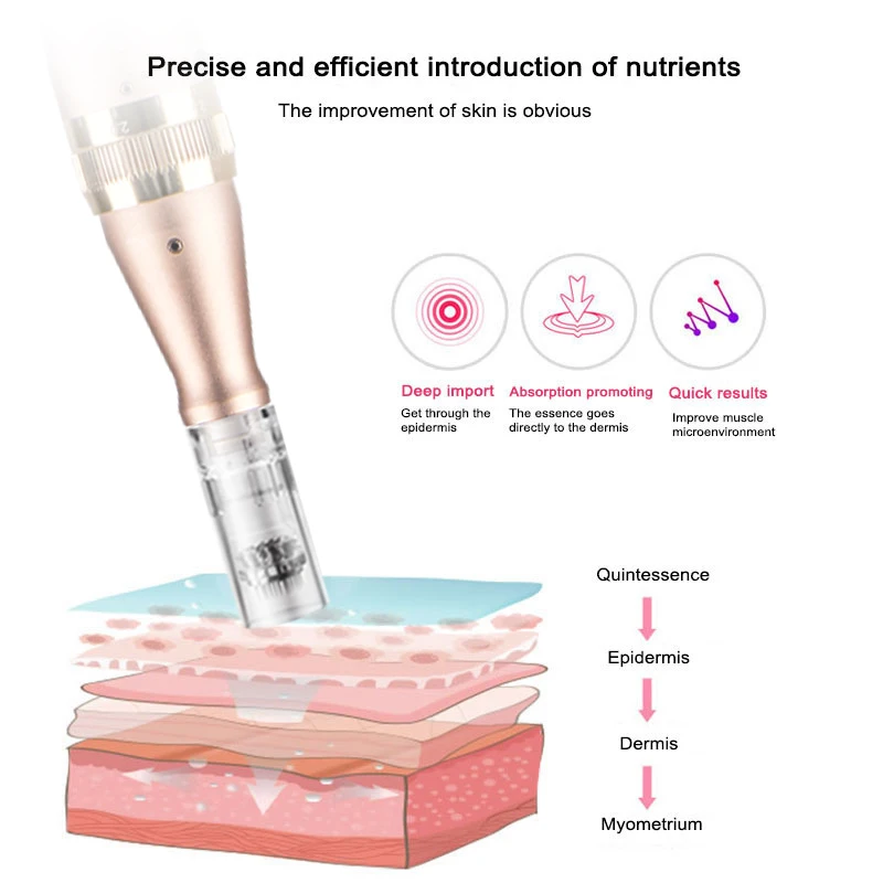 Устройство для Удаления растяжек и шрамов с микроиглами | Красота здоровье