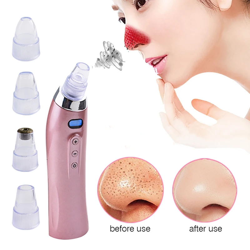 Электрический инструмент для удаления черных точек|Устройство ухода за кожей