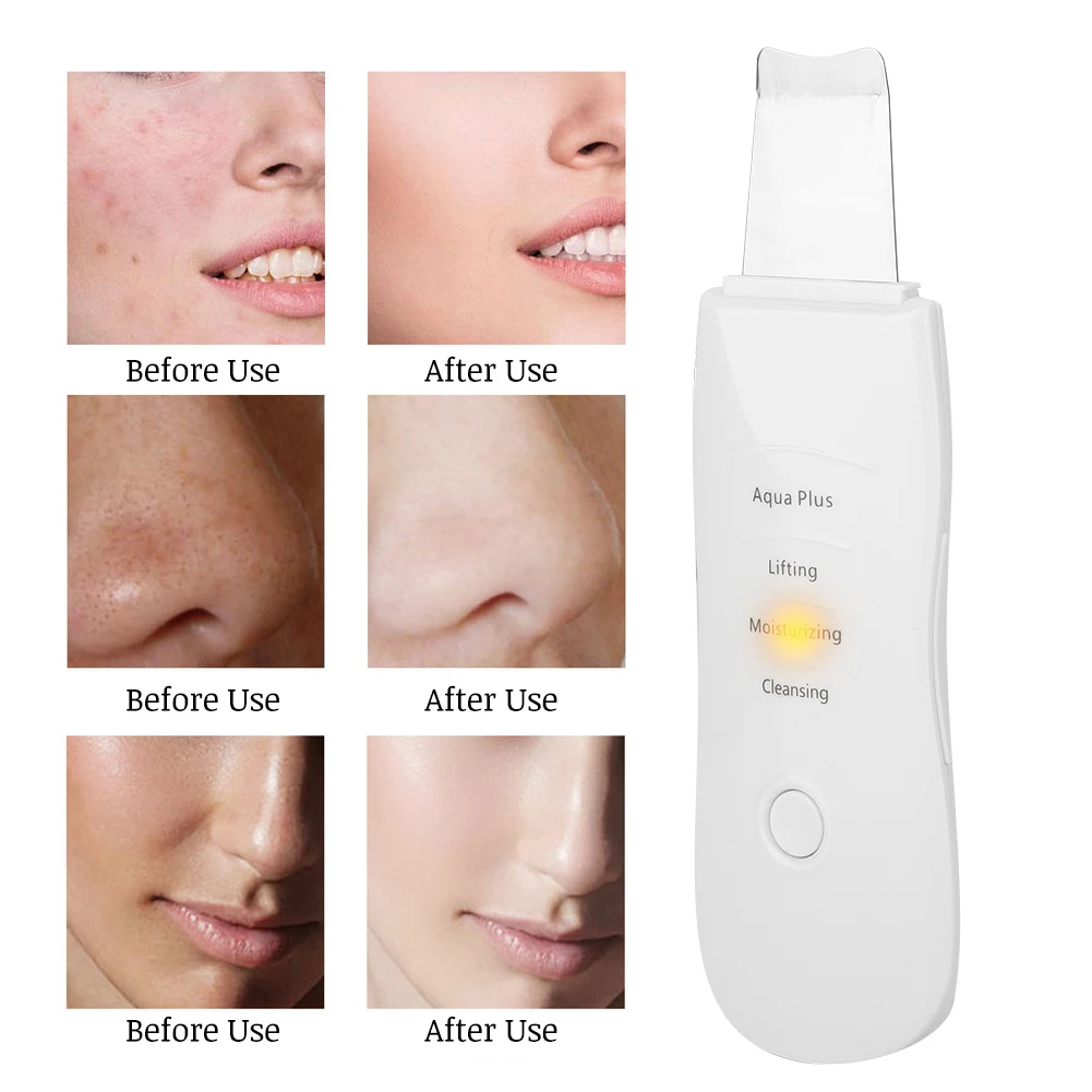 

Ультразвуковой вибрационный скребок для кожи, лопатка для глубокой очистки с ионами, электронная Зарядка от USB