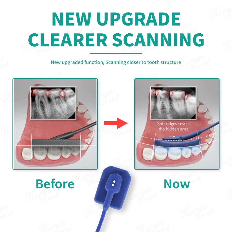 Рисунок 3 - Импортный корейский внутриоральный