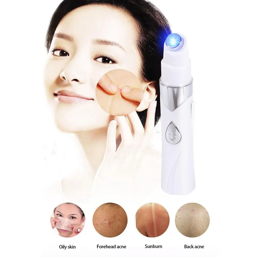 Акне мощный анти варикозное расширение вен лицо ручка для удаления прыщей синий