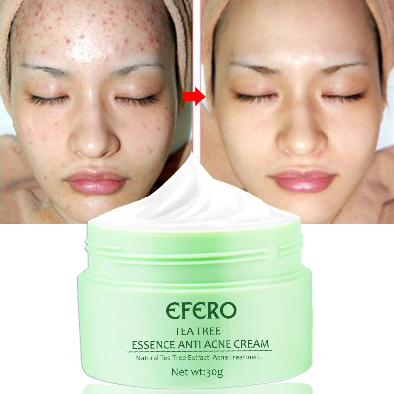 Крем для лица EFERO Tea Tree влажность смягчитель антивозрастное отбеливание удаление