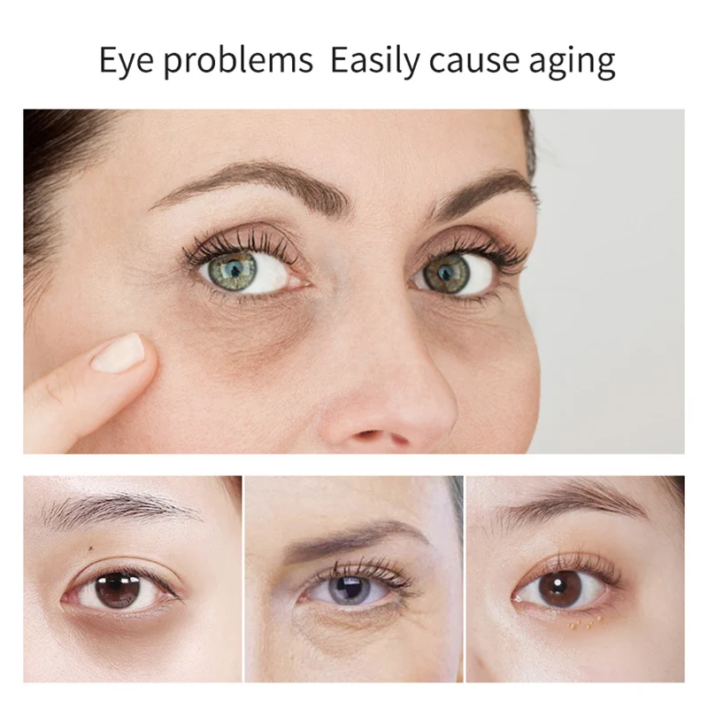 

Moisturizing Eye Cream Remove Dark Circle Anti-Puffiness Anti-Aging Cream Improves Eye Bags Lifts And Tightens Eyes Care TSLM2