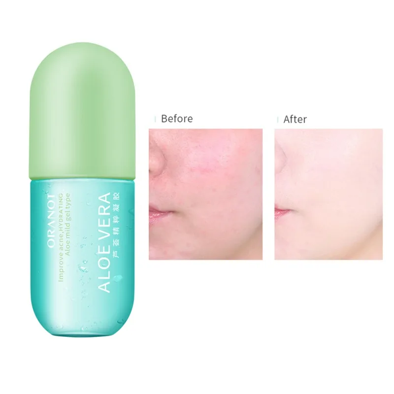 Гель для лица с алоэ вера 50 мл увлажняющее средство против морщин крем от акне