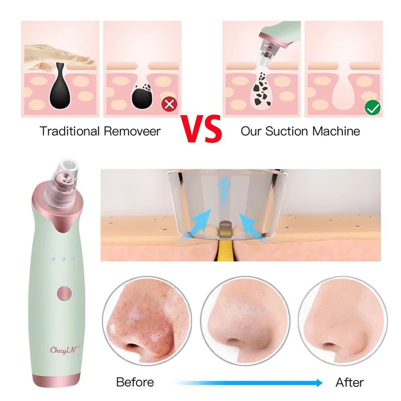 

CkeyiN Vacuum Cleaner Blackhead Remover Black Dot Machine Skin Pore Suction Extractor Nose Cleansing+Moisture Sprayer Steamer