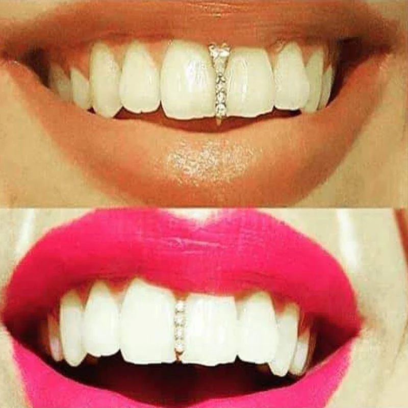Тонкие подтяжки хип хоп золотые зубы Grillz лучшие Грили зубные рот Панк шапки