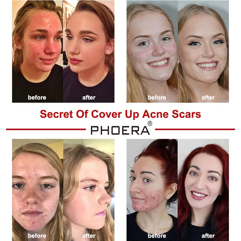 Фотоаппарат для контроля жирности кожи PHOERA TSLM1 с полным покрытием 30 мл| |