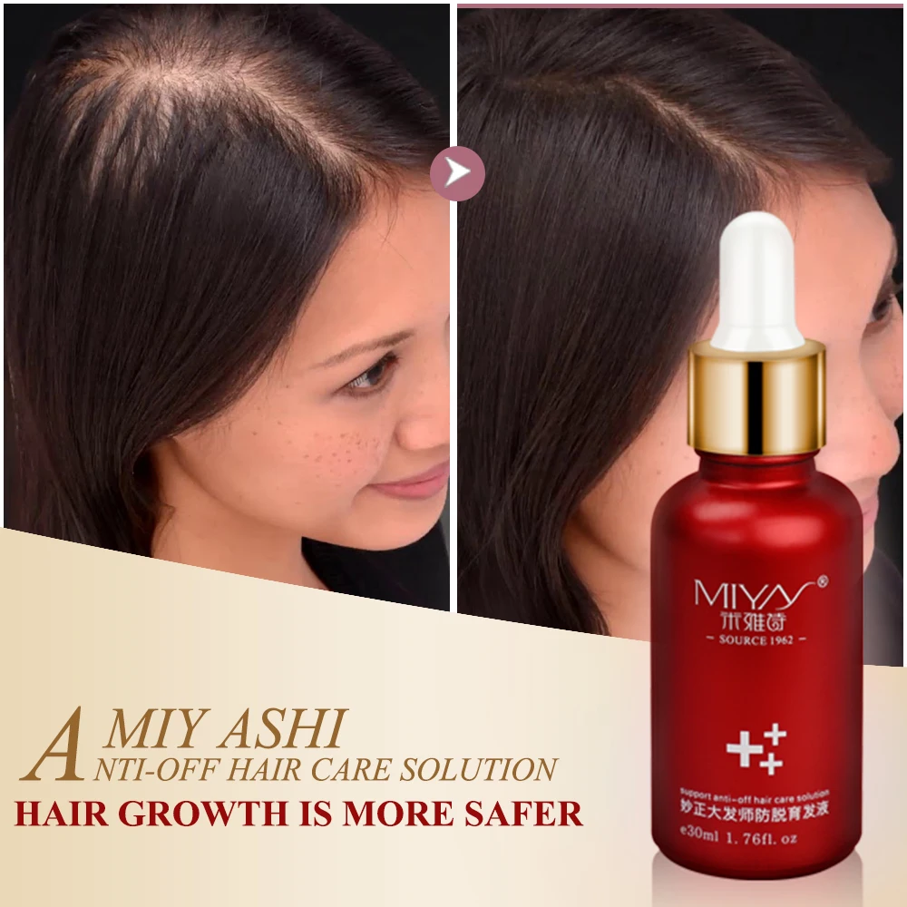 Быстрое эфирное масло для роста волос уход за волосами Питательный раствор