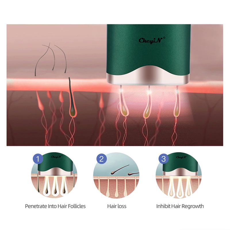 

CkeyiN Laser Epilator 900000 Flash Ipl Hair Removal Laser Permanent Women Shaver Painless Bikini Trimmer Lcd Display Depiladora