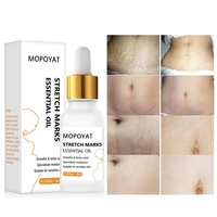 stretch mark remover essential oil skin care treatment nourishing whitening pregnancy repair oil 15ml