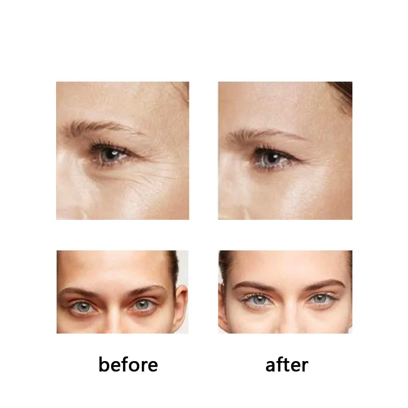 

10Pcs/Lot Ordinary Caffeine Solution 5% + EGCG Reduces Eye Puffiness and Dark Circles Eyes Cosmetic Firming Face Repair Primer