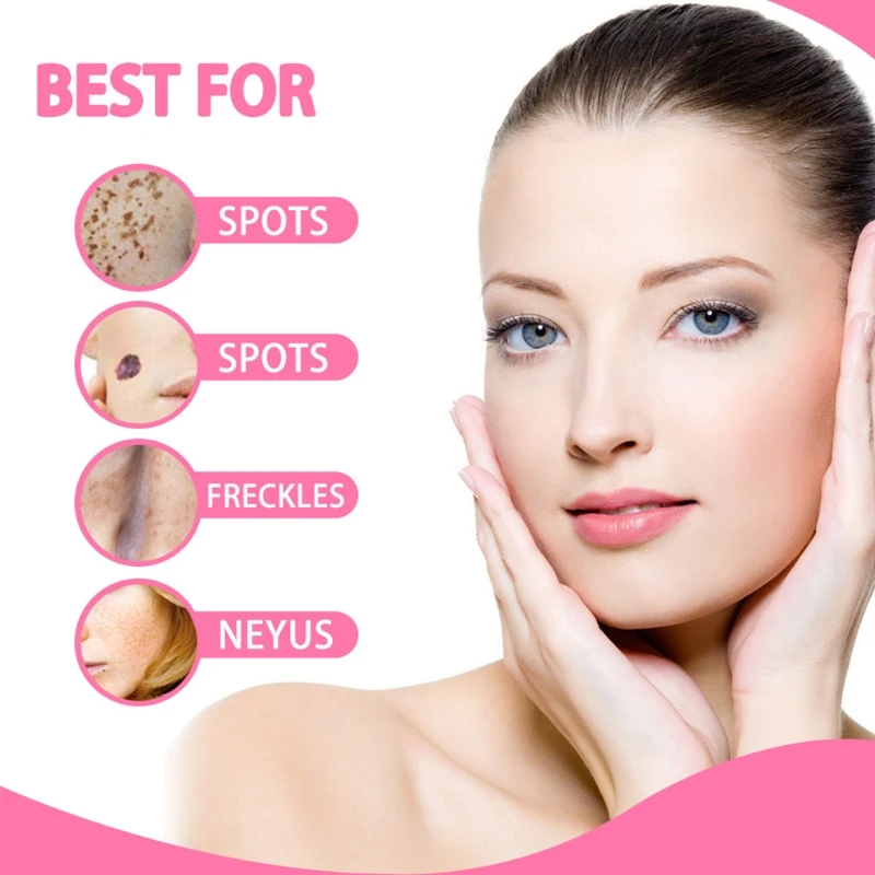 

20ml Organic Skin Tag Solution Serum Painless Labels Mole Removal Freckle Oil K1KB
