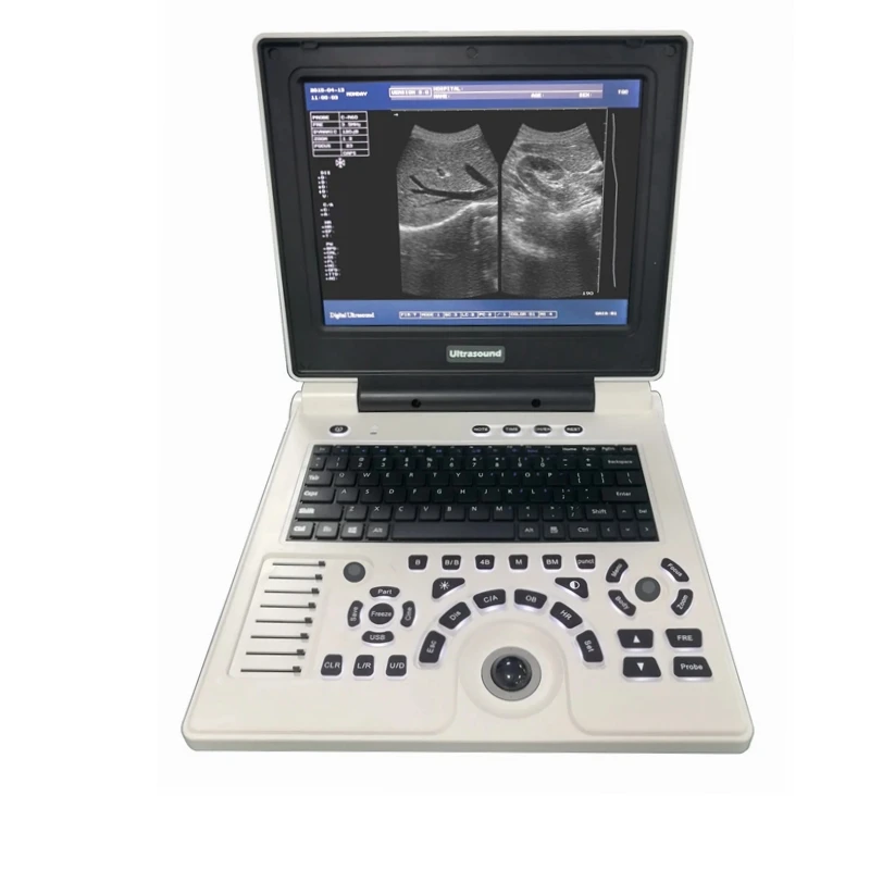 

Professional Laptop Ultrasonic Imaging System Portable Ultrasound Scanner