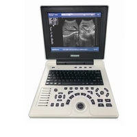professional laptop ultrasonic imaging system portable ultrasound scanner