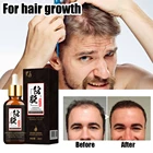 Эфирное масло для роста волос уход за волосами для мужчин t выпадение волос натуральные растительные волосы Regrowth эссенция для мужчин женщин мужчин уход за волосами восстановление продуктов