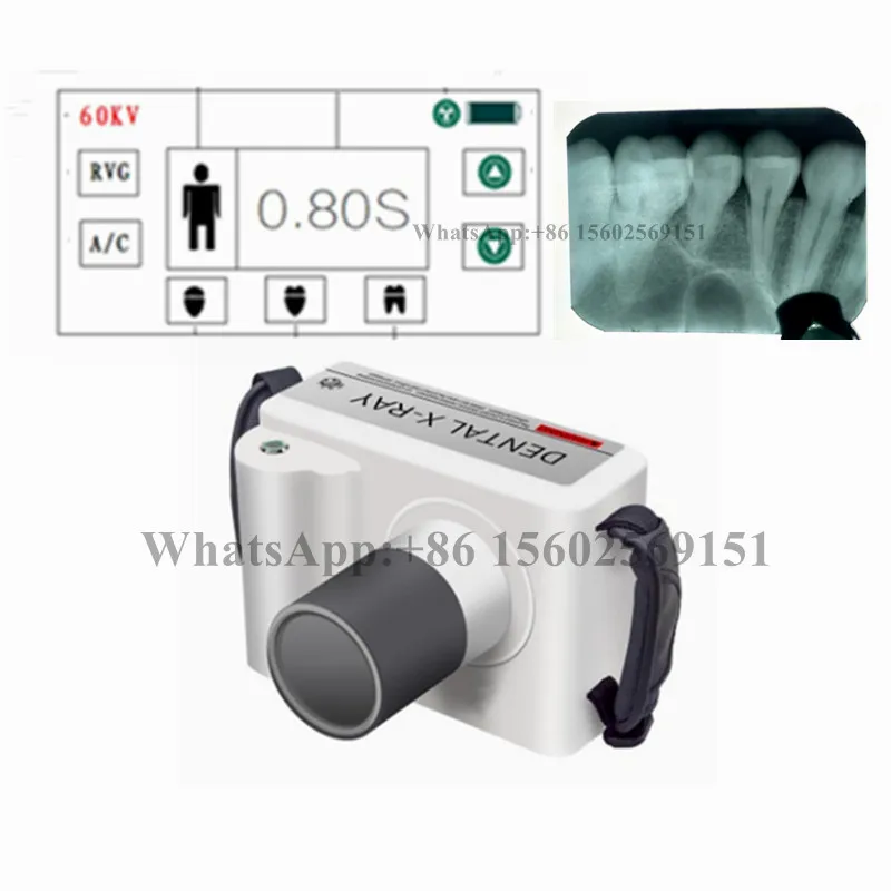 Hot Sale 1Set Dental X-Ray Unit High Frequency Digital Portable Touch Screen X Ray Machine With Big Size 2 Sensor Supplier | Красота и