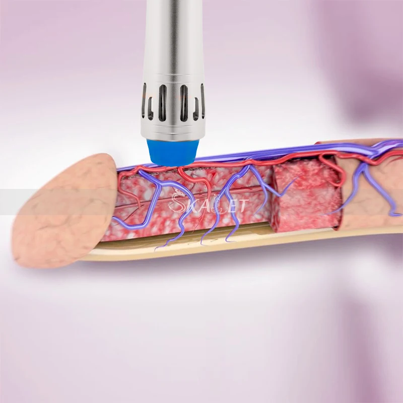 

Home Use ED Erectile Dysfunction Therapy ESWT Extracorporeal Shock Wave Pain Relief Body Massage Equipment Massage Gun