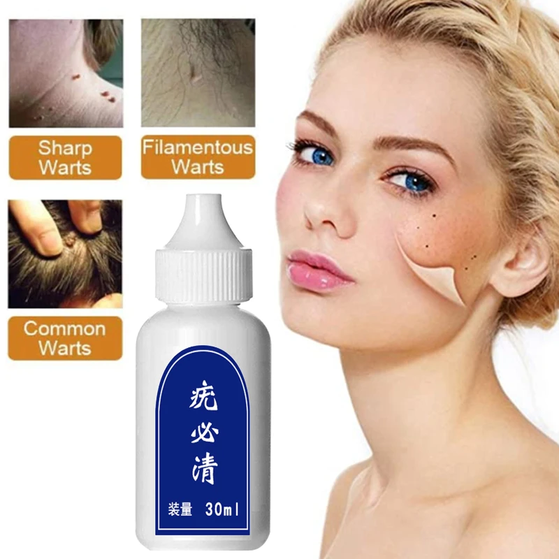 Бирка для удаления бородавок на коже средство лечения гениталий родинок и